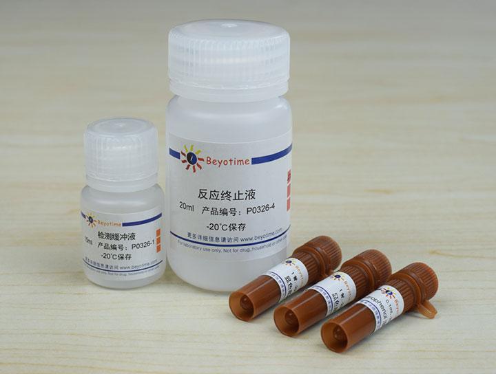 酸性磷酸酶检测试剂盒